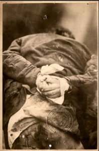 Ce cliché est celui du petit Jules Jacques Schoënen, âgé de 6 ans, assassiné le 25 février 1881. Ses mains ont été ligotées dans le dos avec un tissu blanc. Son pantalon a disparu. C'est l'une des plus anciennes photographie jointe à un dossier criminel.