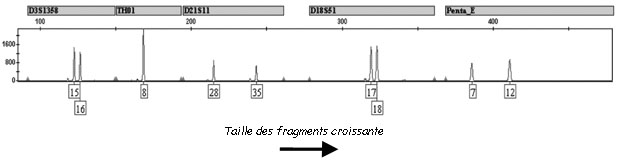 profil ADN aptès électrophorèse police-scientifique.com