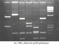 profil génétique électrophorèse