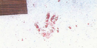 Omar m’a tuer – l’autopsie