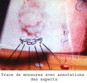 trace de morsure Bundy Police scientifique