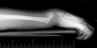 Médecine Légale – Descriptions lésionnelles sur le corps